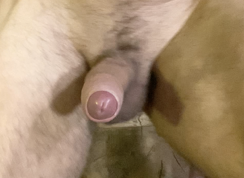 a semi erect penis with foreskin partially retracting to reveal the tip of a deep red glans